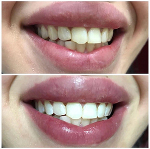 Hammasta fotovalgendus (8 foto / 9)