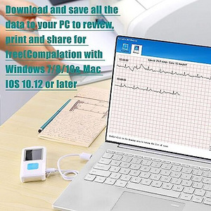 Bluetooth elektrokardiograaf/EKG.UUS! (5 foto / 8)