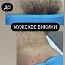 Meeste ja naiste depilatsioon (foto #2)