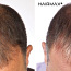 Курс против выпадения волос (фото #3)