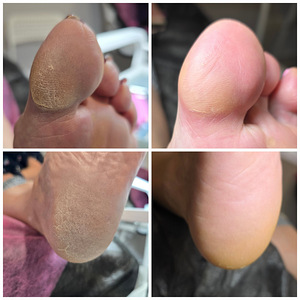 Kombineeritud pediküür+geellakk (3 foto / 3)