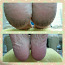 Pediküür probleemsetele jalgadele (foto #1)