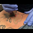 Tattoo eemaldamise laser (foto #3)