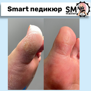 Nutikas pediküür geellakiga (3 foto / 10)
