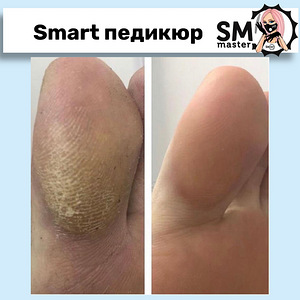 Nutikas pediküür geellakiga (7 foto / 10)